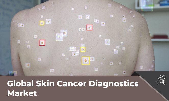 Skin Cancer Diagnostics Market - Inkwood Research
