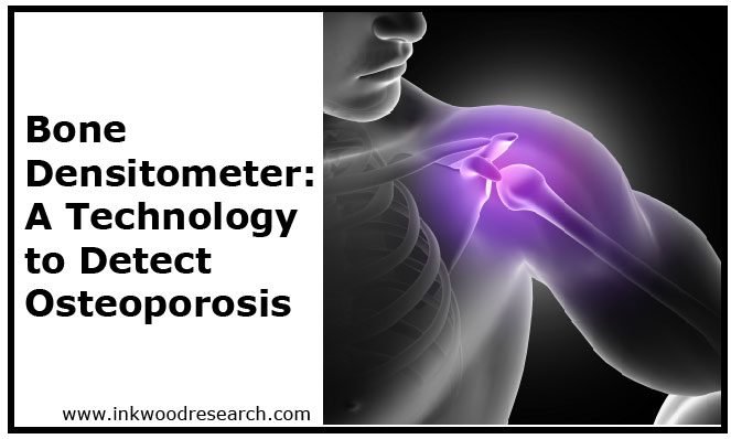 Bone-Densitometer-Technology-to-Detect-Osteoporosis